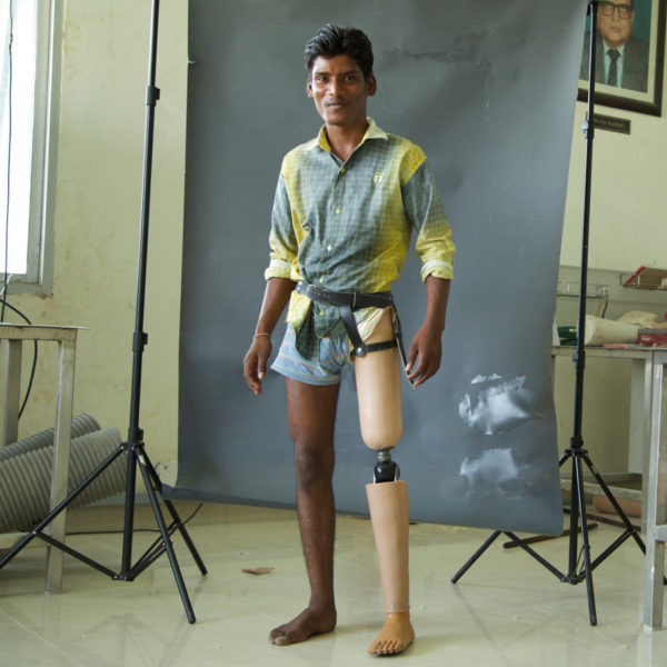 Picture of man with prosthetic leg