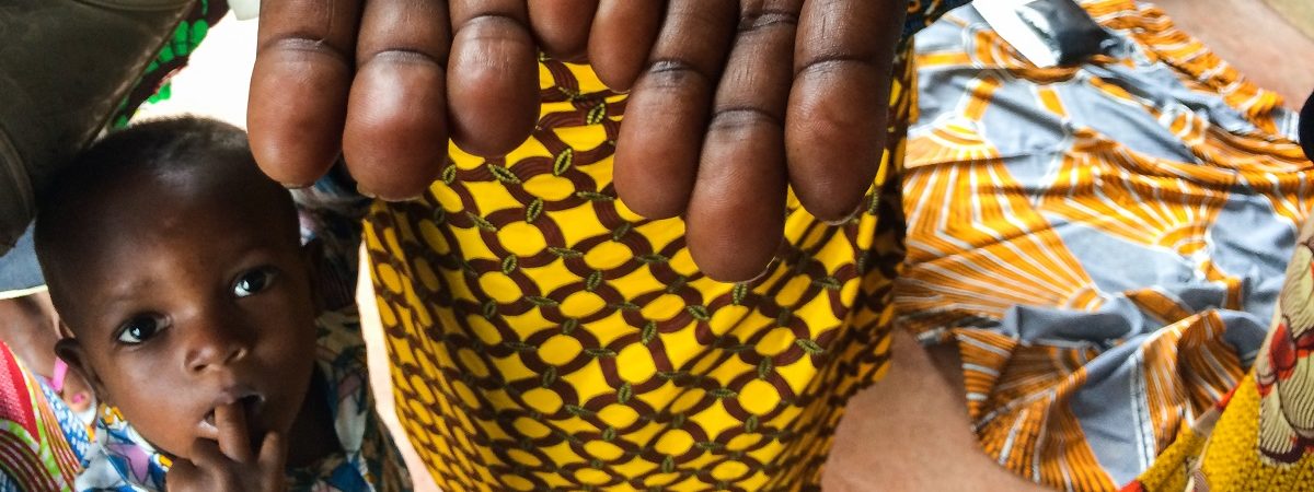 Woman hold outs her hands to show her finger prints, a little boy stands close by